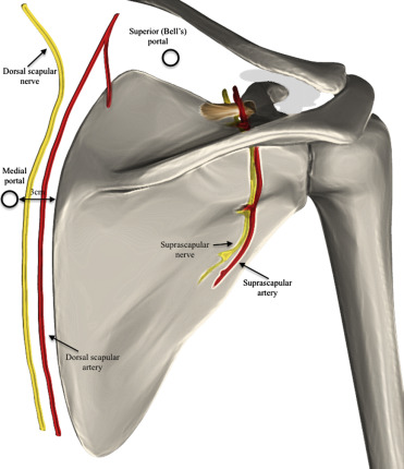 Snapping Scapula Syndrome