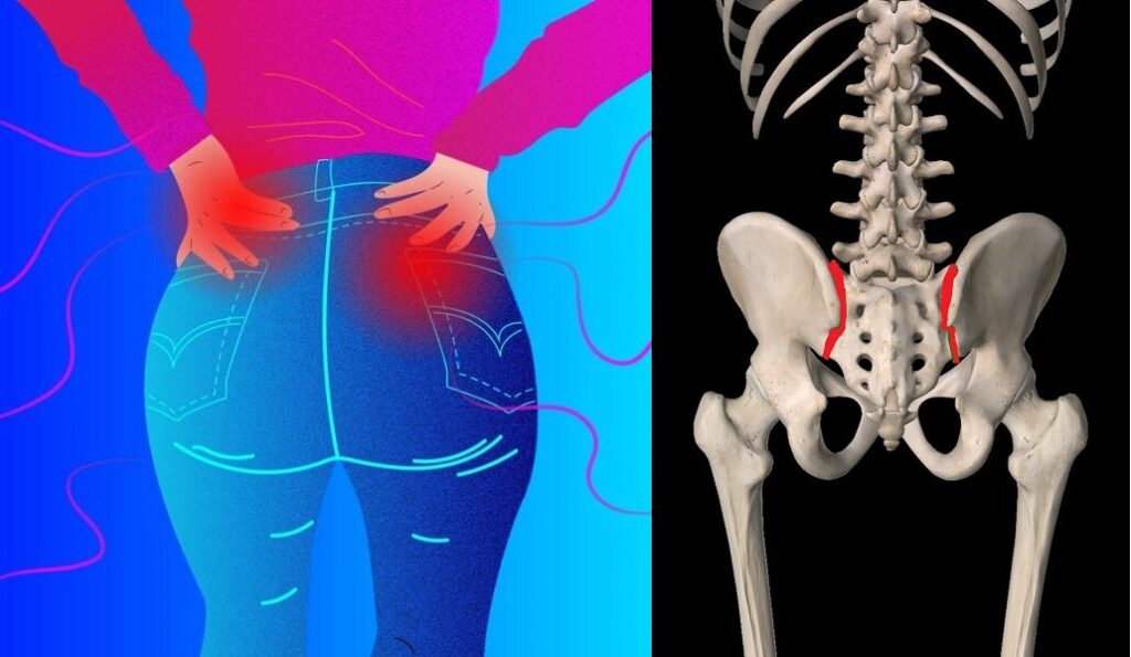 sacroiliac joint