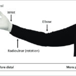 Proximal and Distal