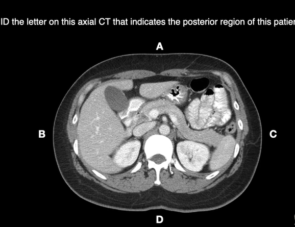 Anterior and Posterior