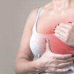 breast cancer