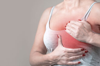 breast cancer