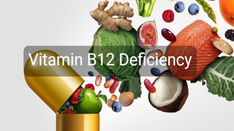Vitamin B12 